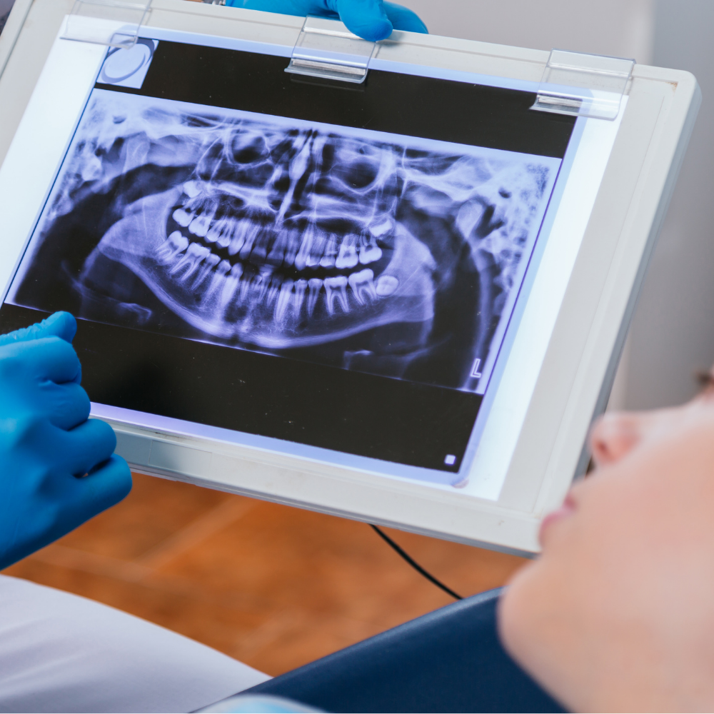 Dra. Bruna Luiza Meotti - Cirurgia Bucomaxilofacial: Tratamentos Avançados com Especialistas